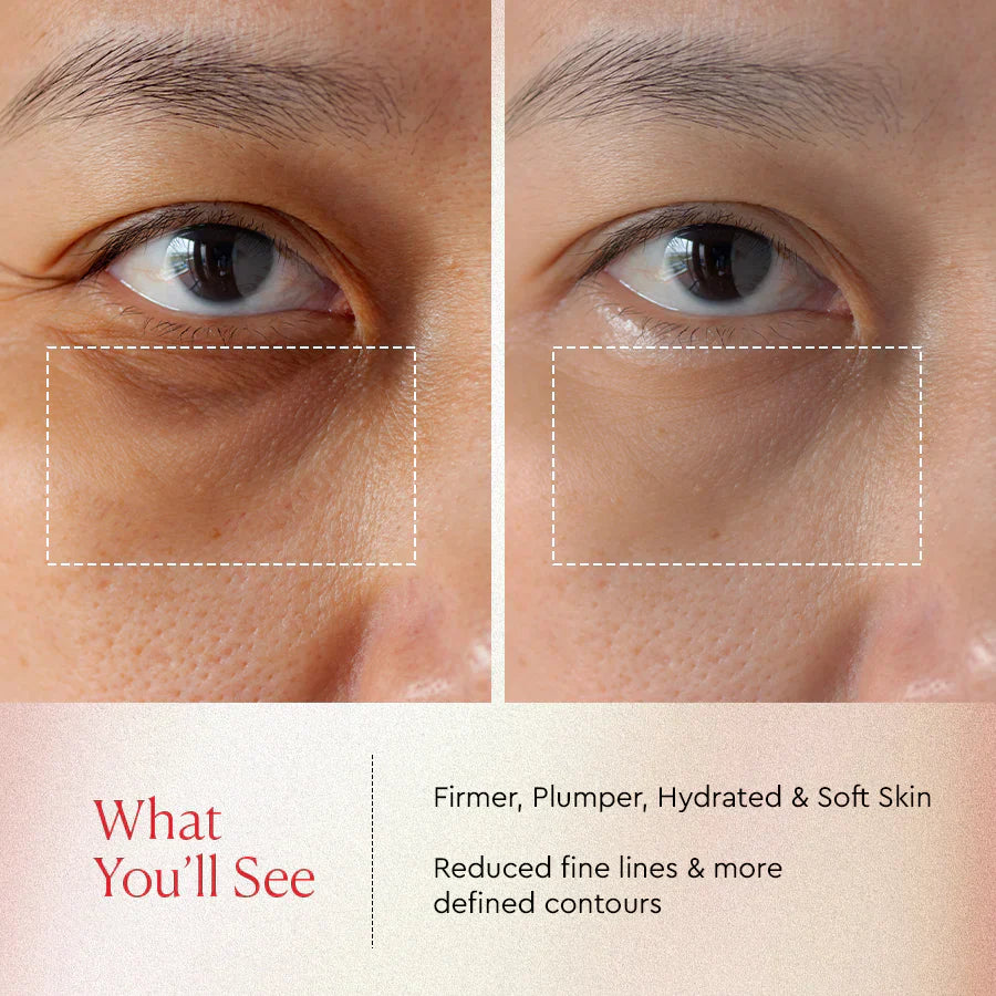 Glow Up 2026: The Future of Skin Tightening Serum & Collagen Trends You Can't Miss!