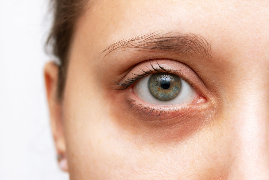 Best Eye Cream Ingredients That Actually Work for Dark Circles and Puffiness (Science-Backed Guide)