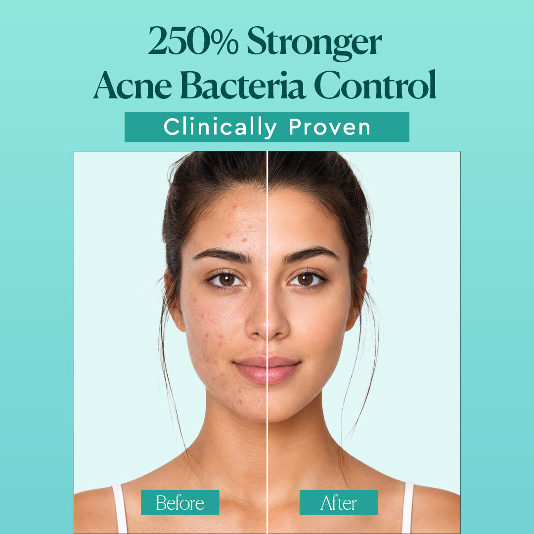 Dr Belmeur AHA BHA Sebum Control Gel Cleanser For Acne Prone Skin With Salicylic Acid